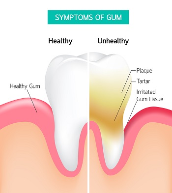 Nashville Restorative Dentistry